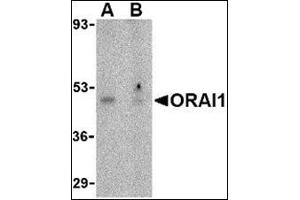 Western blot analysis of ORAI1 in human ovary tissue lysate with this product at 1 μg/ml in the (A) absence or (B) presence of blocking peptide. (ORAI1 抗体  (N-Term))