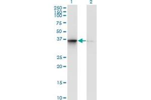 Western Blot analysis of TSNAXIP1 expression in transfected 293T cell line by TSNAXIP1 monoclonal antibody (M02), clone 1D6. (Tsnaxip1 抗体  (AA 269-364))
