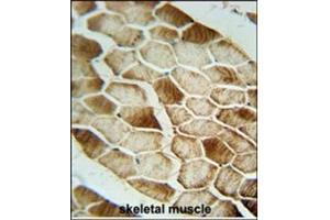 Immunohistochemistry analysis in Formalin Fixed, Paraffin Embedded Human skeletal muscle stained with SAR1B antibody (Center) followed by peroxidase conjugation of the secondary antibody and DAB staining. (SAR1B 抗体  (Middle Region))