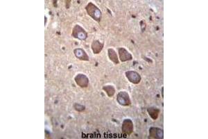 Immunohistochemistry (IHC) image for anti-Protocadherin alpha 3 (PCDHA3) antibody (ABIN2996548) (PCDHA3 抗体)
