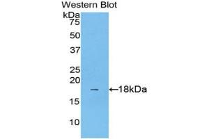 Western blot analysis of the recombinant protein. (IL1A 抗体  (AA 111-204))
