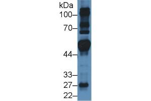 Western blot analysis of Mouse Heart lysate, using Human FRS2 Antibody (3 µg/ml) and HRP-conjugated Goat Anti-Rabbit antibody ( (FRS2 抗体  (AA 239-449))