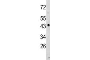 Western blot analysis of NDRG1 antibody and MDA-MB231 lysate