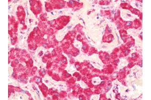 Anti-UQCRC1 antibody IHC staining of human liver. (UQCRC1 抗体  (AA 46-305))