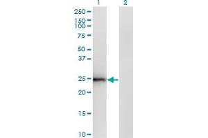 Western Blotting (WB) image for anti-Cell Death-Inducing DFFA-Like Effector B (CIDEB) (AA 3-111) antibody (ABIN599215) (CIDEB 抗体  (AA 3-111))