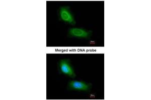 ICC/IF Image Immunofluorescence analysis of paraformaldehyde-fixed HeLa, using CCDC68, antibody at 1:200 dilution. (CCDC68 抗体)