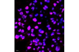 Immunofluorescence (Paraffin-embedded Sections) (IF (p)) image for anti-Survival Motor Neuron Domain Containing 1 (SMNDC1) antibody (ABIN7075773)