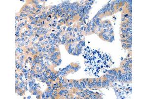 Immunohistochemistry (IHC) image for anti-Low Density Lipoprotein Receptor-Related Protein Associated Protein 1 (LRPAP1) antibody (ABIN1680715) (LRPAP1 抗体)
