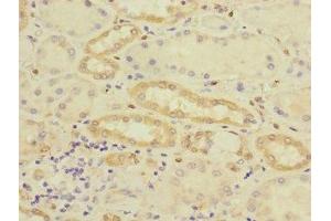 Immunohistochemistry of paraffin-embedded human kidney tissue using ABIN7149055 at dilution of 1:100 (CRIP2 抗体  (AA 1-208))