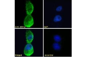 ABIN570879 Immunofluorescence analysis of paraformaldehyde fixed U2OS cells, permeabilized with 0.
