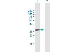 Western Blot analysis of RASSF3 expression in transfected 293T cell line by RASSF3 MaxPab polyclonal antibody. (RASSF3 抗体  (AA 1-238))