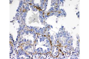 Immunohistochemistry (IHC) image for anti-C-Fos Induced Growth Factor (Vascular Endothelial Growth Factor D) (Figf) (AA 89-205) antibody (ABIN3044524)