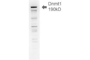 Dnmt1, 18ug H1299 lysate 1 in1000 Western Blotting. (DNMT1 抗体  (AA 637-650))
