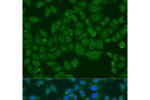 Immunofluorescence analysis of U2OS cells using INPP5K Polyclonal Antibody at dilution of 1:100. (INPP5K 抗体)