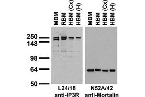 Immunoblots on brain membranes prepared from whole rat (RBM) and mouse (MBM) brain, and from human cerebral cortex [HBM(Cx)] and hippocampus [HBM(H)].