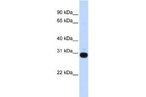 WB Suggested Anti-VASH1 Antibody Titration: 0. (VASH1 抗体  (Middle Region))