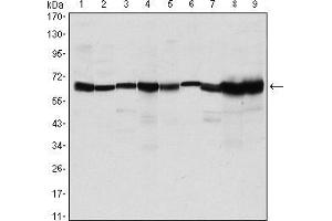 Western blot analysis using CARM1 mouse mAb against MCF-7 (1), Hela (2), NIH/3T3 (3), HL-60 (4), LNcap (5), Jurkat (6), PC-3 (7), Cos7 (8), and PC-12 (9) cell lysate.