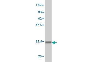 Western Blot detection against Immunogen (33. (HOXD9 抗体  (AA 146-210))