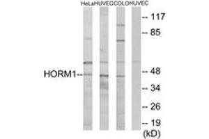 Western Blotting (WB) image for anti-HORMA Domain Containing 1 (HORMAD1) (AA 321-370) antibody (ABIN2889660) (HORMAD1 抗体  (AA 321-370))