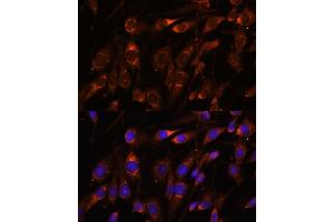 Immunofluorescence analysis of C6 cells using FARSB antibody (ABIN7269267) at dilution of 1:100. (FARSB 抗体  (AA 240-589))