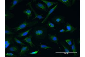 Immunofluorescence of purified MaxPab antibody to CETN3 on HeLa cell. (CETN3 抗体  (AA 1-167))