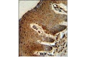 PTMS Antibody (C-term) (ABIN653227 and ABIN2842761) IHC analysis in formalin fixed and paraffin embedded human skin followed by peroxidase conjugation of the secondary antibody and DAB staining. (Parathymosin 抗体  (C-Term))