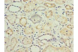 Immunohistochemistry of paraffin-embedded human kidney tissue using ABIN7157726 at dilution of 1:100 (KLF3 抗体  (AA 1-240))