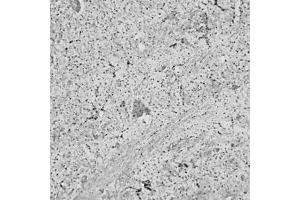 Immunohistochemistry (IHC) image for anti-Ras Homolog Gene Family, Member A (RHOA) (AA 100-150) antibody (ABIN351037)