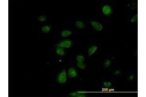Image no. 4 for anti-CDK5 Regulatory Subunit Associated Protein 3 (CDK5RAP3) (AA 1-507) antibody (ABIN599311) (CDK5RAP3 抗体  (AA 1-507))