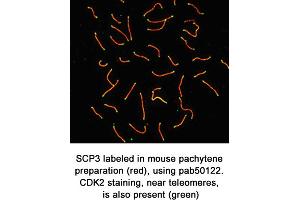 Image no. 1 for anti-Synaptonemal Complex Protein 3 (SYCP3) (C-Term) antibody (ABIN363431) (SYCP3 抗体  (C-Term))