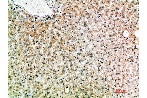 Immunohistochemical analysis of paraffin-embedded human-liver, antibody was diluted at 1:200 (IL-19 抗体  (AA 51-100))