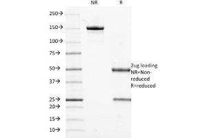 SDS-PAGE Analysis of Purified, BSA-Free Cytokeratin 18 Antibody (clone DE-K18). (Cytokeratin 18 抗体)