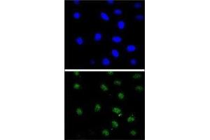 Confocal immunofluorescent analysis of PTEN antibody with 293 cells followed by Alexa Fluor 488-conjugated goat anti-rabbit lgG (green). (PTEN 抗体  (AA 306-335))