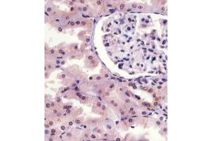 (ABIN6241064 and ABIN6578961) staining IRAK1 in human kidney tissue sections by Immunohistochemistry (IHC-P - paraformaldehyde-fixed, paraffin-embedded sections).