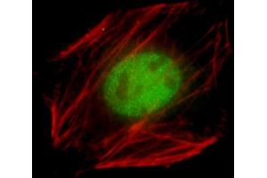 Immunofluorescent analysis of 4 % paraformaldehyde-fixed, 0. (NK2 Homeobox 5 抗体  (AA 98-133))