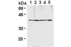 Western Blotting (WB) image for anti-Heterogeneous Nuclear Ribonucleoprotein A2/B1 (HNRNPA2B1) antibody (ABIN1449240) (HNRNPA2B1 抗体)