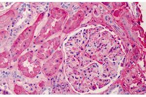 Human Kidney: Formalin-Fixed, Paraffin-Embedded (FFPE) (APOA1 抗体)
