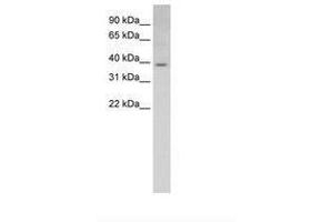Image no. 1 for anti-E74-Like Factor 3 (Ets Domain Transcription Factor, Epithelial-Specific) (ELF3) (AA 201-250) antibody (ABIN6736609)