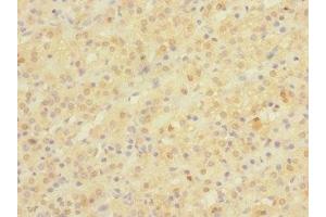 Immunohistochemistry of paraffin-embedded human adrenal gland tissue using ABIN7161998 at dilution of 1:100