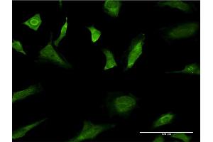 Immunofluorescence of monoclonal antibody to MAPK3 on HeLa cell. (ERK1 抗体  (AA 279-379))