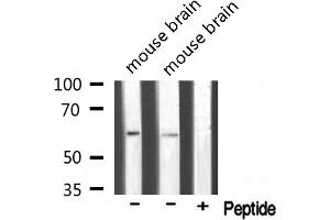 Western blot analysis of extracts of various samples,using T3JAM Antibody. (TRAF3IP3 抗体  (Internal Region))