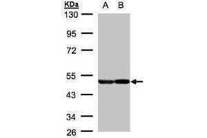 WB Image Sample(30 μg of whole cell lysate) A:A431, B:H1299 10% SDS PAGE antibody diluted at 1:2000 (ENO2/NSE 抗体)