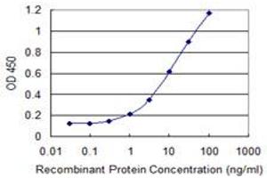 Detection limit for recombinant GST tagged SDS is 0. (serine Dehydratase 抗体  (AA 1-218))