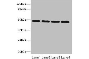 Western blot All lanes: INHBB antibody at 2 μg/mL Lane 1: U87 whole cell lysate Lane 2: A549 whole cell lysate Lane 3: A431 whole cell lysate Lane 4: Hela whole cell lysate Secondary Goat polyclonal to rabbit IgG at 1/10000 dilution Predicted band size: 46 kDa Observed band size: 46 kDa (INHBB 抗体  (AA 295-405))