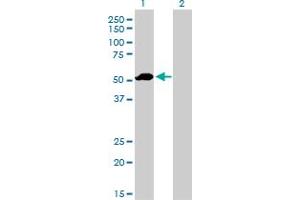 Western Blot analysis of F9 expression in transfected 293T cell line by F9 monoclonal antibody (M01), clone 2C9. (Coagulation Factor IX 抗体  (AA 96-190))