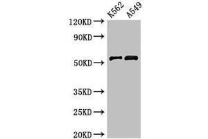 Western Blot Positive WB detected in: K562 whole cell lysate, A549 whole cell lysate All lanes: CELF2 antibody at 3 μg/mL Secondary Goat polyclonal to rabbit IgG at 1/50000 dilution Predicted band size: 55, 53, 56 kDa Observed band size: 55 kDa (CELF2 抗体  (AA 291-381))