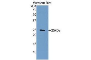 Western Blotting (WB) image for anti-Fibulin 2 (FBLN2) (AA 858-1069) antibody (ABIN1176012) (FBLN2 抗体  (AA 858-1069))
