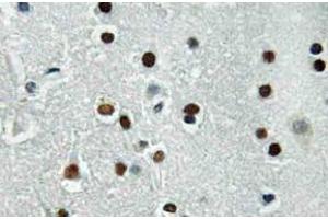 Immunohistochemistry (IHC) analyzes of ASCL1 antibody in paraffin-embedded human brain tissue. (ASCL1 抗体)