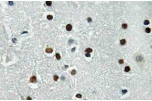 Immunohistochemistry (IHC) analyzes of ASCL1 antibody in paraffin-embedded human brain tissue.