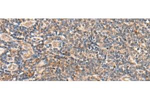Immunohistochemistry of paraffin-embedded Human tonsil tissue using SEC22B Polyclonal Antibody at dilution of 1:60(x200) (SEC22B 抗体)